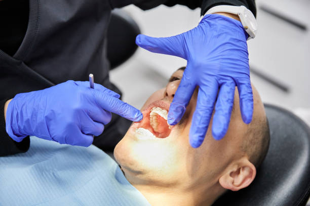 Best Dentist for Tooth Abscess  in Versailles, IN