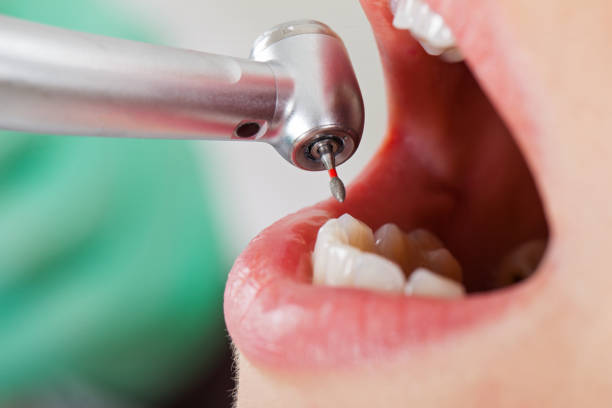 Best Cracked Tooth Emergency Dentist  in Versailles, IN